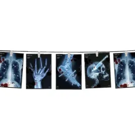 girlanda-baner-ze-zdjeciami-x-ray-rentgen-300-cm-3-m-dekoracje-halloween