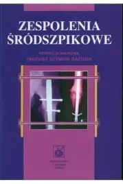 zespolenia-srodszpikowe