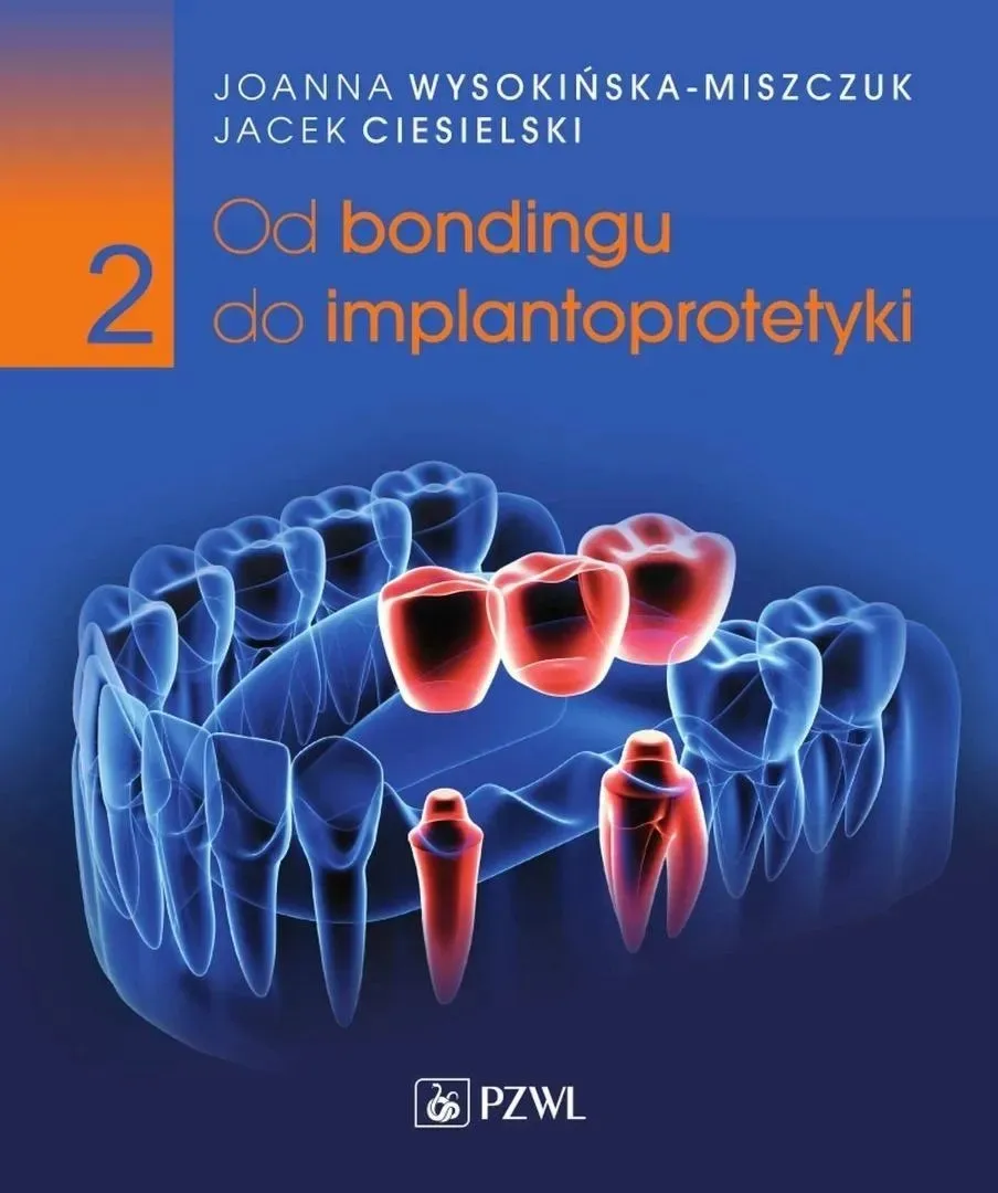 od-bondingu-do-implantoprotetyki-cz-2