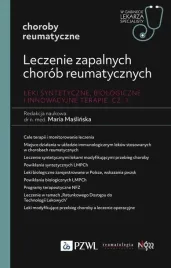 leczenie-zapalnych-chorob-reumatycznych