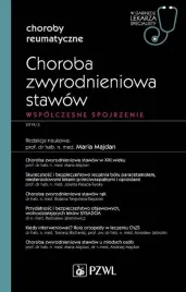choroba-zwyrodnieniowa-stawow-w-gabinecie-lekarza