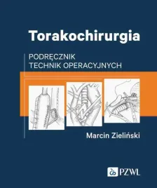 torakochirurgia-podrecznik-technik-operacyjnych