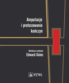 amputacje-i-protezowanie-konczyn
