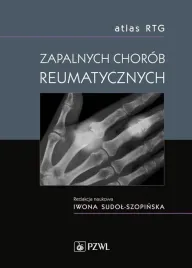atlas-rtg-zapalnych-chorob-reumatycznych