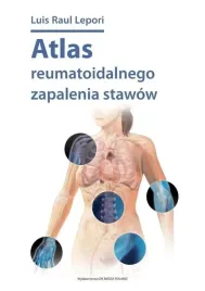 atlas-reumatoidalnego-zapalenia-stawow