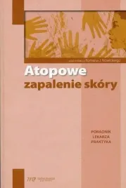 atopowe-zapalenie-skory-poradnik-lekarza-praktyka