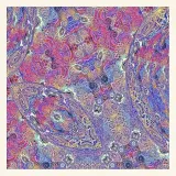 placenta-vinyl