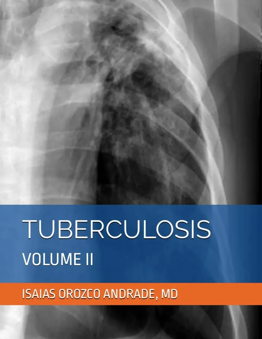 tuberculosis-volume-ii-tuberculosis-2024-third-english-edition-stan-nowy