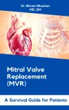 mitral-valve-replacement-mvr-a-survival-guide-for-patients