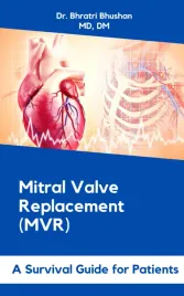 mitral-valve-replacement-mvr-a-survival-guide-for-patients