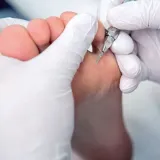 dluto-podologiczne-2mm-20szt-stan-opakowania-oryginalne