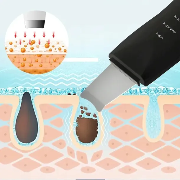 peeling-kawitacyjny-ultrasonic-funkcje-peeling-ultradzwieki