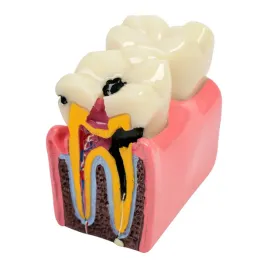 model-choroby-zebow-1952-medyczny-eu