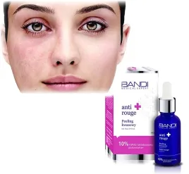 bandi-medical-peeling-kwasowy-naczynka-30-ml