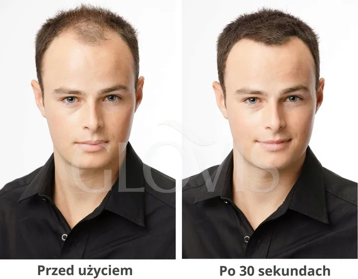 glovis-spray-applicator-dozujaca-pompka-do-wlokien-kolor-mikrowlokien-inny