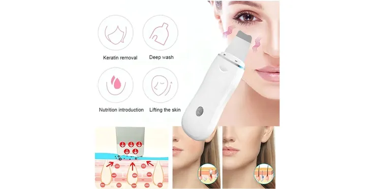 peeling-kawitacyjny-kawitacyjny-funkcje-sonoforeza-peeling-inne