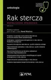 rak-stercza-wspolczesne-spojrzenie