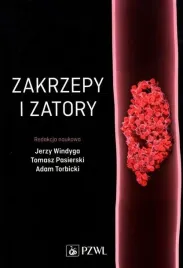 zakrzepy-i-zatory