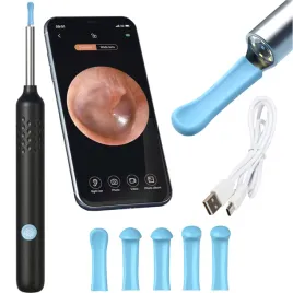 smart-otoskop-kamera-czyszczenie-do-uszu-wosk-wifi-hd-aplikacja-endoskop