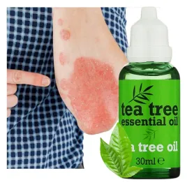 tea-tree-30ml-olejek-z-drzewa-herbacianego-herbaciany-duze-stezenie-mocny