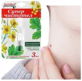 odcisk-na-stopie-z-korzeniem-jak-usunac-modzele-nagniotki-kurzajka-glistni-stan-nowy