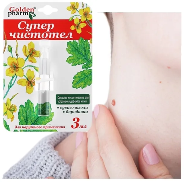 odcisk-na-stopie-z-korzeniem-jak-usunac-modzele-nagniotki-kurzajka-glistni