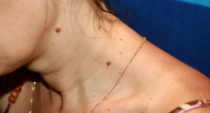 odcisk-na-stopie-z-korzeniem-jak-usunac-modzele-nagniotki-kurzajka-glistni-wielkosc-produkt-pelnowymiarowy