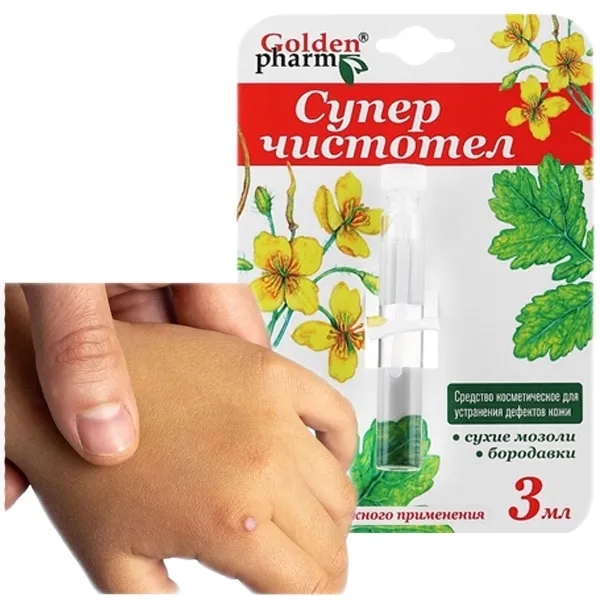 odcisk-na-stopie-z-korzeniem-jak-usunac-modzele-nagniotki-kurzajka-glistni-stan-opakowania-oryginalne