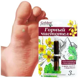 odcisk-na-stopie-z-korzeniem-jak-usunac-modzele-nagniotki-kurzajka-glistni