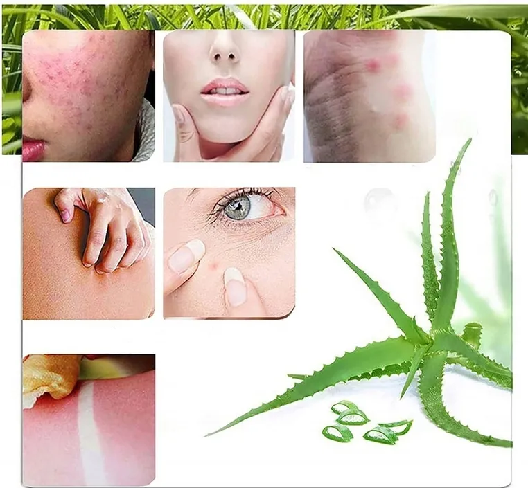 czysty-zel-aloesowy-aloe-vera-naturalny-do-twarzy-ciala-wlosow-laroxy