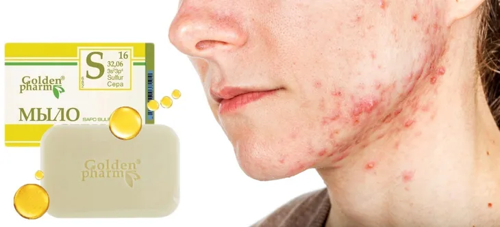 mydlo-z-kwasem-salicylowym-siarkowe-na-lupiez-pstry-mocne-opakowanie-kartonik