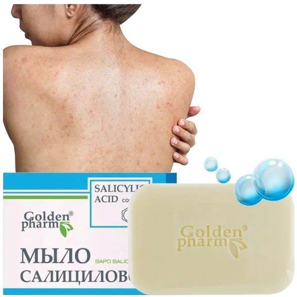 mydlo-z-kwasem-salicylowym-siarkowe-na-lupiez-pstry-mocne