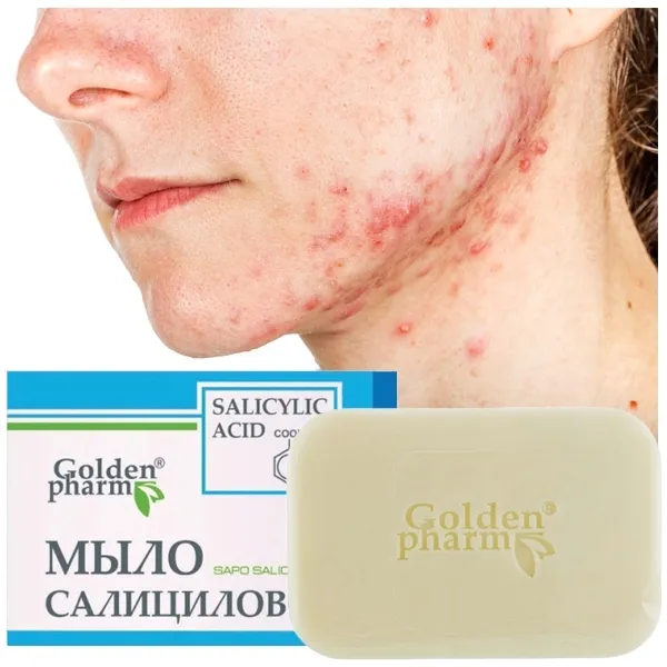 mydlo-z-kwasem-salicylowym-siarkowe-na-lupiez-pstry-mocne