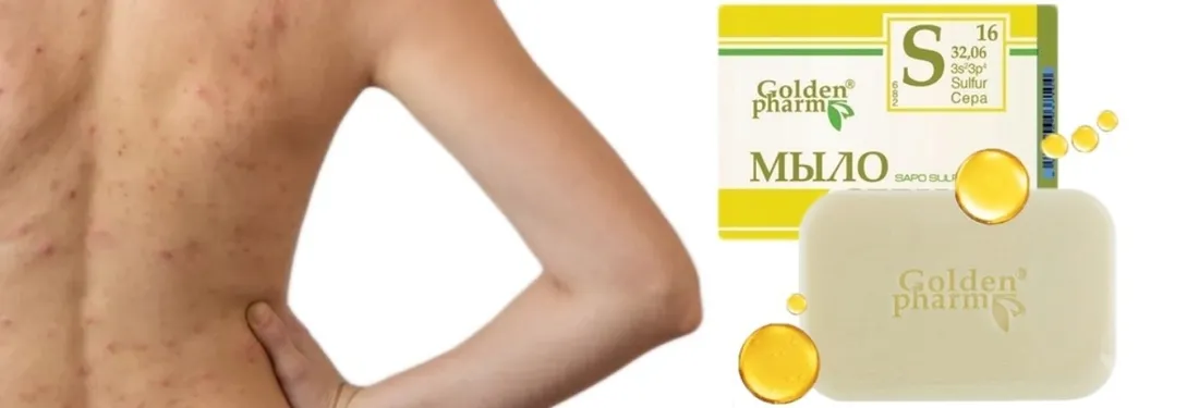 mydlo-z-kwasem-salicylowym-siarkowe-na-lupiez-pstry-mocne