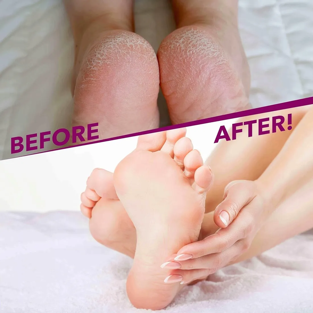 skarpetki-kosmetyczne-do-zabiegow-silikonowe-do-spania-na-noc-parafiny