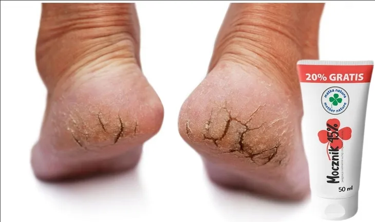 dobry-krem-do-suchych-piet-z-mocznikiem-45-skarpetki-do-kremu-kosmetyczne-stan-nowy-opakowanie-tubka