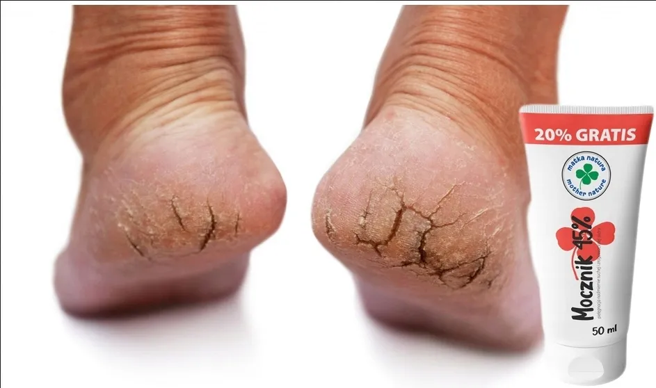 dobry-krem-do-suchych-piet-z-mocznikiem-45-skarpetki-do-kremu-kosmetyczne