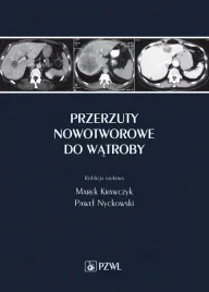 przerzuty-nowotworowe-do-watroby-marek-krawczyk