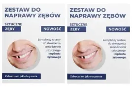 2x-sztuczne-zeby-proteza-zebow-zestaw-naprawczy-do-wypelniania-ubytkow-zeba