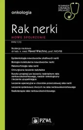 rak-nerki-wspolczesne-spojrzenie-pawel-wiechno