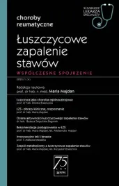 luszczycowe-zapalenie-stawow-maria-majdan