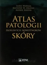 atlas-patologii-zlosliwych-nowotworow-skory-leszek-wozniak