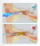 urzadzenie-do-czyszczenia-uszu-medi-grade-kod-producenta-mg-ear-erk01-eu