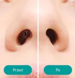 trymer-medi-grade-hea-btk01-mozliwosc-mycia-pod-woda-brak-informacji