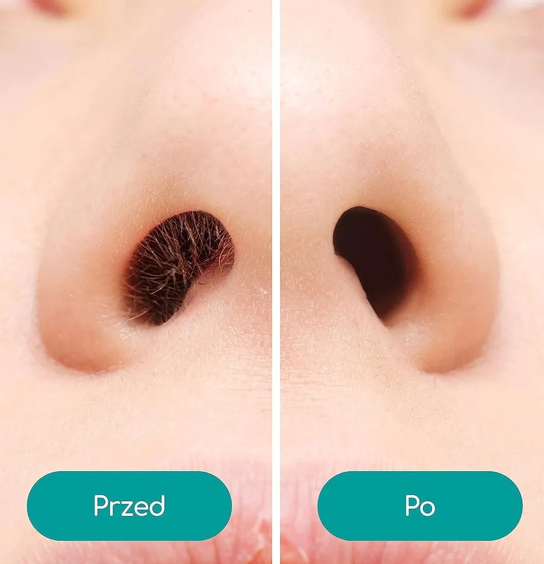 trymer-medi-grade-hea-btk01-stan-nowy