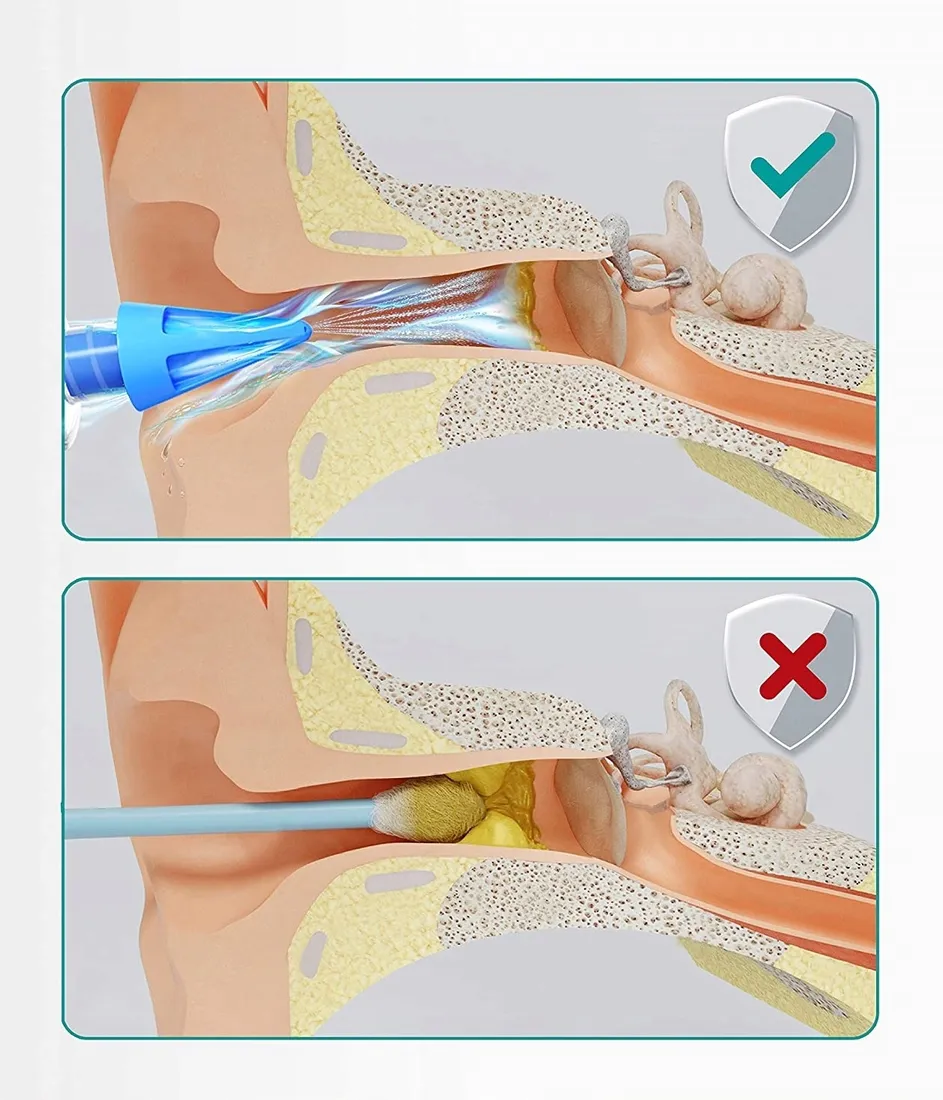 urzadzenie-do-czyszczenia-uszu-medi-grade