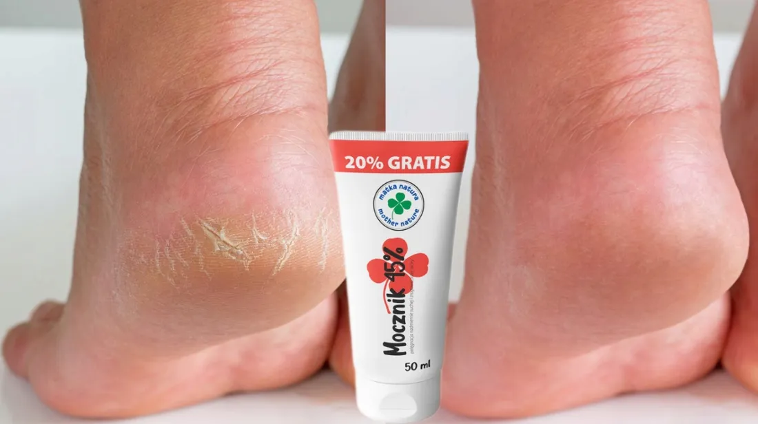 mocznik-45percent-60ml-stan-nowy