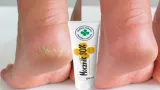 mocznik-30percent-80ml-przeznaczenie-bole-miesniowo-stawowe