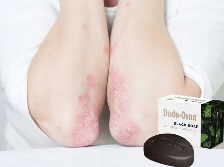 mydlo-dudu-classic-150g