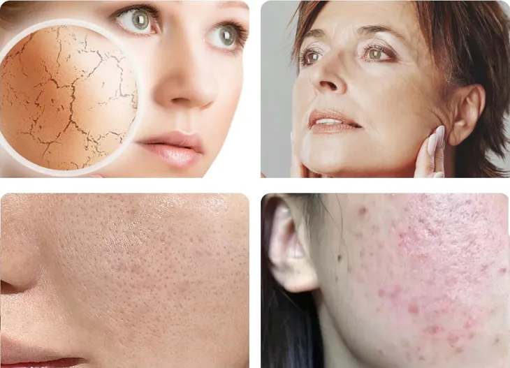 krem-ze-sluzem-slimaka-kolagen-na-zmarszczki-blizny-rozstepy-150ml-wielkosc-produkt-pelnowymiarowy